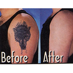 Tattoo Cover